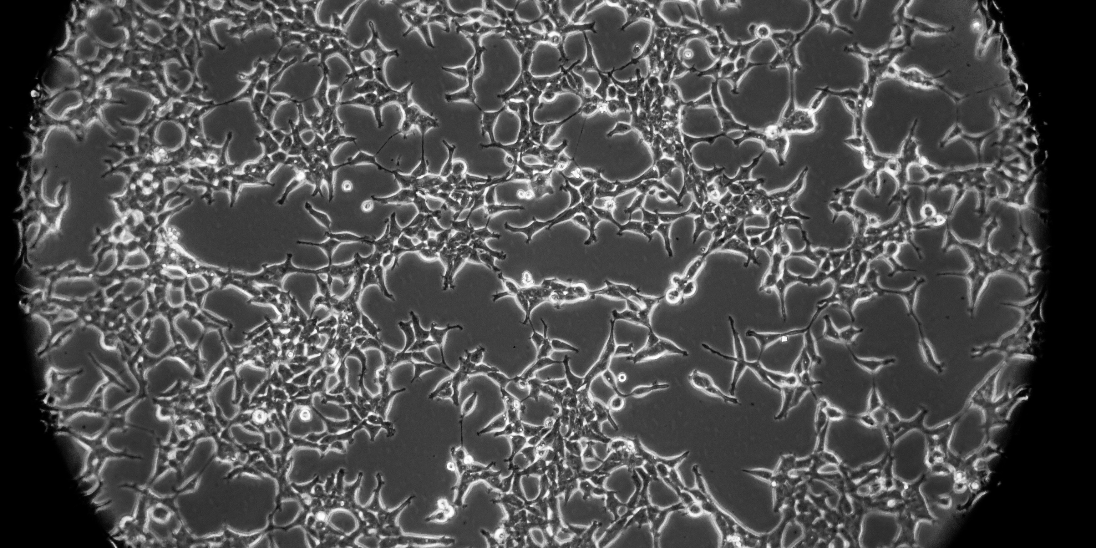 hek293-an-essential-human-cell-line-with-a-unexpected-origin